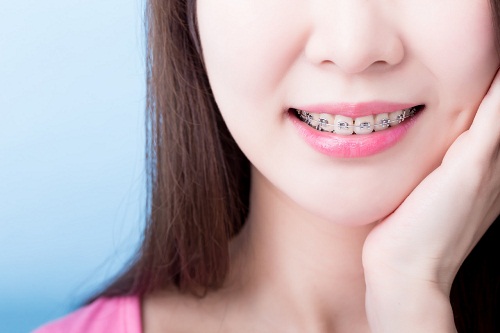 请问深圳爱康健牙科牙齿矫正后为保持器一般要戴多久?