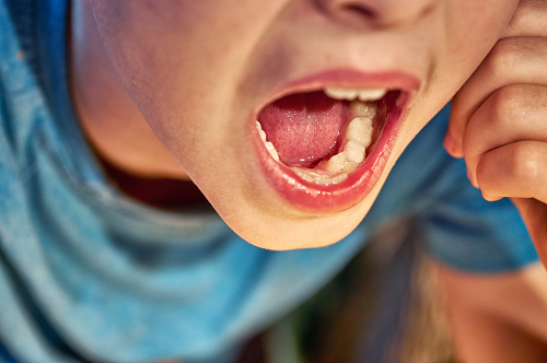 问深圳爱康健口腔导致孩子牙齿畸形的原因有哪些?