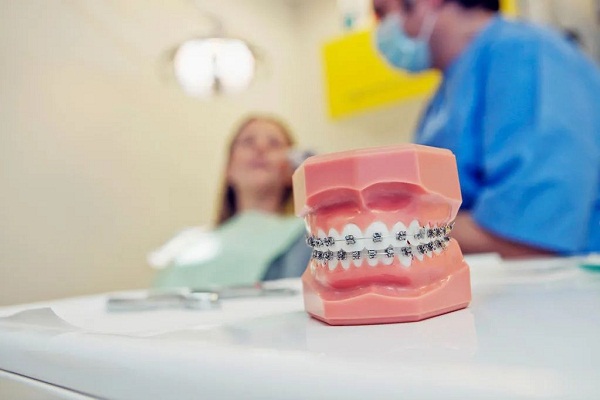 牙齒矯正過程中頻繁掉托槽?深圳箍牙收費價目表?