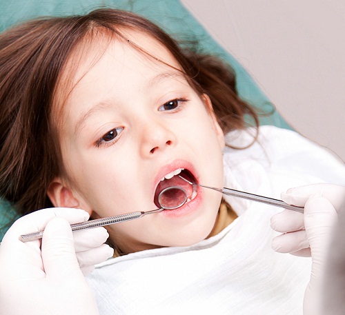 深圳兒童補牙多少錢一顆